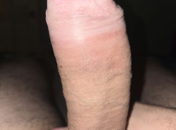 Член